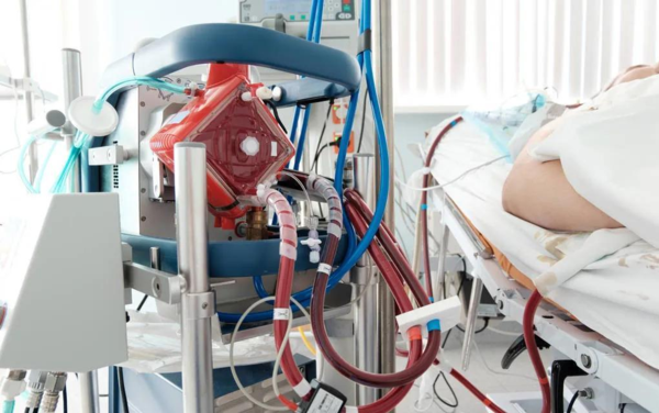 熱點 | 填補國產(chǎn)空白，ECMO迎來&ldquo;中國造&rdquo;